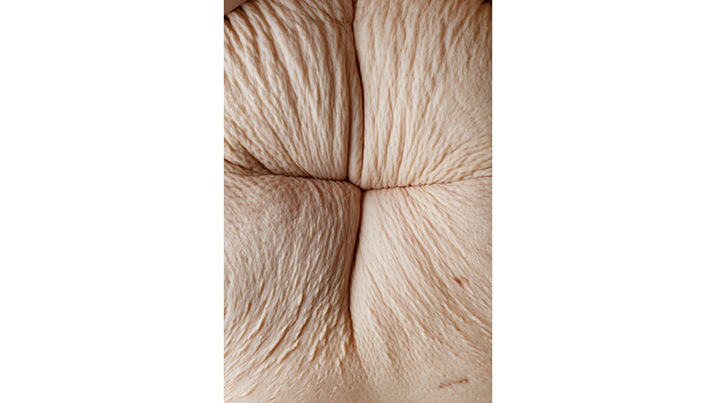 Illustration for article titled Stunning Photography Project Explores The Dark Side of Weight Loss (NSFW)